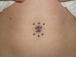 Bauch